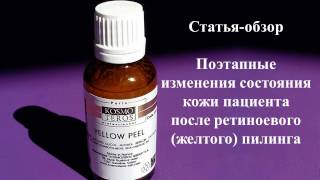 Желтый ретиноевый пилинг Kosmoteros Professionnel (г. Красноярск )