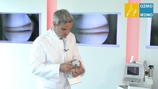Prof. Dr. Diehl: Meniskus - Ursachen Meniskusriss & minimalinvasive Versorgungsmöglichkeiten