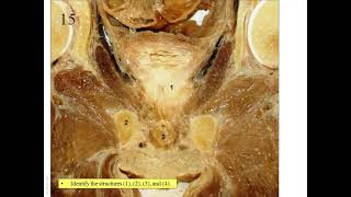 OSPE in Anatomy of Endocrine and Reproductive Systems