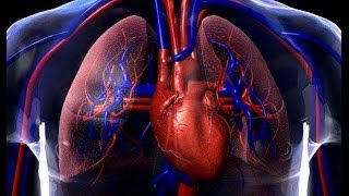 Infarto E Cirurgia Cardiaca