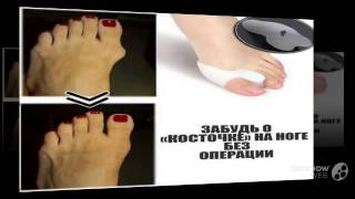 valgus plus купить в иркутске

  - Гелевый корректор большого пальца Valgus Pro