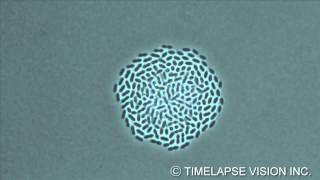 Growth of Streptococcus pneumoniae -肺炎球菌の増殖-