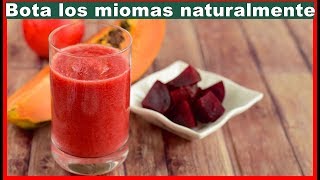 Adiós al mioma uterino, te mostrare de forma natural como hacerlo