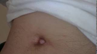 My Bellybutton ready for torture...