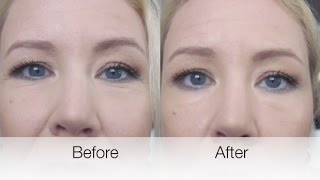 INSTANTLY TRANSFORM VERY DRY CAKEY CONCEALER | BEAUTY OVER 40