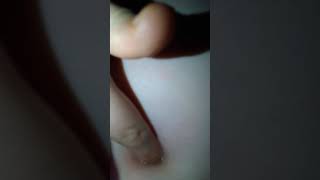 Mixing spit in my belly button