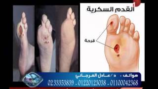 حصريا.. أحدث طرق العلاج بالأكسجين النشط مع الدكتور عادل الفرجاني في دريم كلينيك
