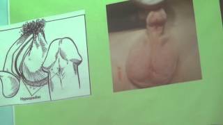 SEMIOLOGIA CLASE 12 PARTE 1