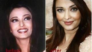 Aishwarya Rai had plastic surgery, before and after photos