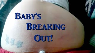 HUGE Baby Movement! | Baby Trying to Break Out at 36 Weeks Pregnant! | MISSY YANDOW