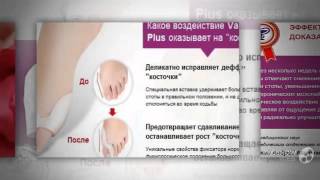 вальгусное отклонение первого пальца стопы

  -  Дефект ”шишек” на ноге??
