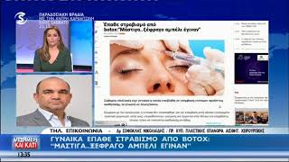 Γυναίκα έπαθε στραβισμό από το Botox