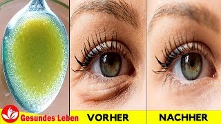 Verwenden Sie Diese Mischung Und Verabschieden Sie Sich Von Augenringen - Falten Um Die Augen