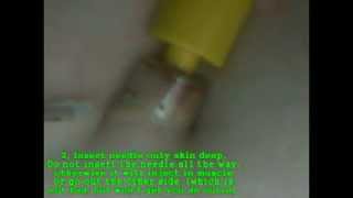 3 different ways to inject saline into a belly button