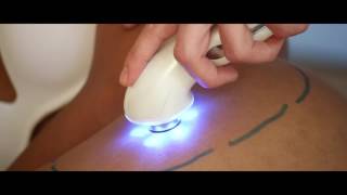 Visite préopératoire avec Lipovisor™