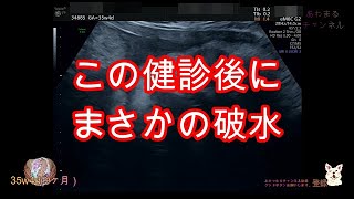 【妊娠健診最終回】35ｗ4ｄ（9ヶ月）エコー＆4D　胎児順調に成長中でしたが・・・ premature baby low weight birth infant