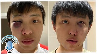 The Treatment of Asians Gets Out of Hand