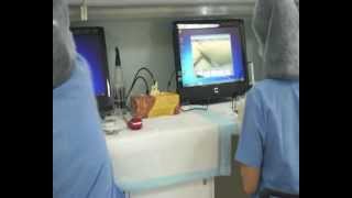 Vinci Digital Hair Graft Dissection in Hair Transplants