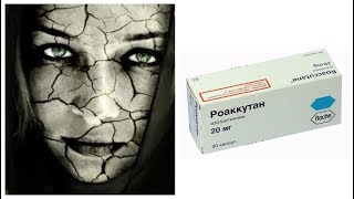 Изотретиноин (Роаккутан) - применение, побочки, рекомендации, отзывы