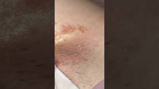 смотреть не всем Жесткая интимная депиляция #18