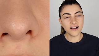 ÇÖZÜM YOK DEMEYİN | CANLI CANLI SiYAH NOKTA YOK ETME ! GERÇEK
