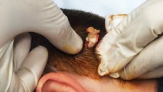 Gross! Doctor removes a Sebaceous Cyst from a scalp