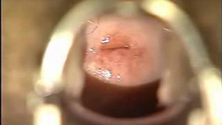 Gynecology   Gyno Pelvic Exam Training