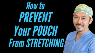 Prevent Pouch Stretching: Dr. V's 8 Step Eating Method for WLS Patients
