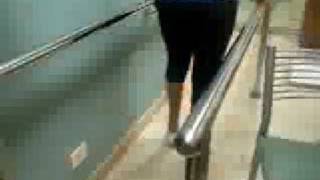 Maritza: primeros pasos con la protesis - above knee leg amputee