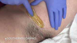 Hairy Bikini Line Sugar