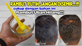 TAK USAH PERAWATAN MAHAL, CUMA PAKAI INI UBAN SEKEPALA BISA HILANG DALAM HITUNGAN HARI