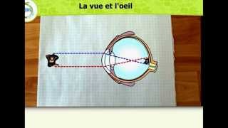 Anomalies de l'œil humaine