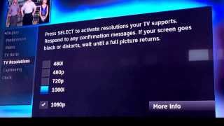 Setting up xbox one with directv dvr
