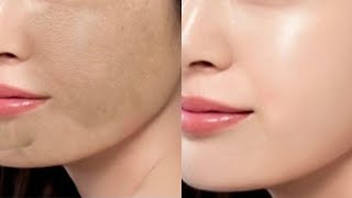 BLANQUEA TU CARA AL INSTANTE  | ACLARAR LAS MANCHAS - BLANQUEAR LA PIEL (EFECTO INMEDIATO)