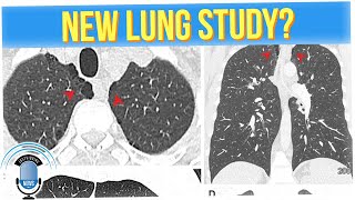 New Study Shows Which Smokers Are More Likely to Get Lung Disease