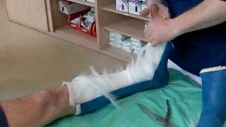 Na 4 weken gips eraf