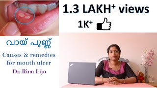 വായ് പുണ്ണ്  (കാരണവും, ചികിത്സയും), Mouth Ulcer (Canker sores)