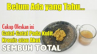TAK USAH BURU-BURU KE DOKTER, GATAL JENIS APAPUN SEMBUH ALAMI