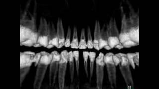pacs dicom