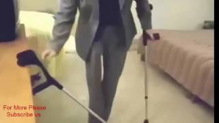 One Legged Amputee girl with Double Crutches walking