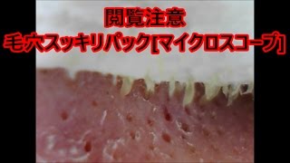 閲覧注意　毛穴スッキリパック　[マイクロスコープ]