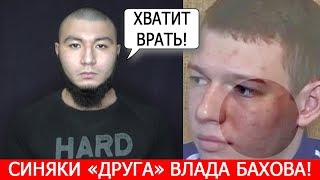 ВЛАДА БАХОВА УБИЛ ЛУЧШИЙ ДРУГ!? ОТКУДА СИНЯКИ? БУДДА ГРИШНА И ПЕТИЦИЯ!