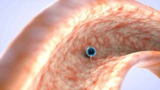Fecundacion in vitro (Parte 1) - Dexeus Mujer