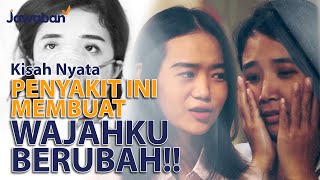 MUJIZAT KESEMBUHAN KARENA PENYAKIT LANGKA!! | #kisahnyata Anne Dwi Ari