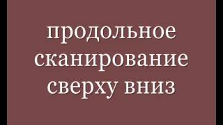Нагноившаяся киста урахуса.