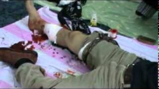 تعب المشوار منك يا بشار الجحش