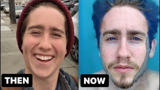 Beard Timeline (FTM Transgender)