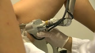 Sécheresse vaginale : le traitement au laser - Allô Docteurs