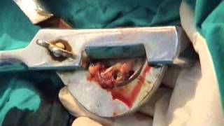 Castration in Equine