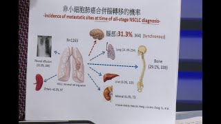 【名醫妙方】認識肺癌晚期的治療與「腦轉移」2022.08.01